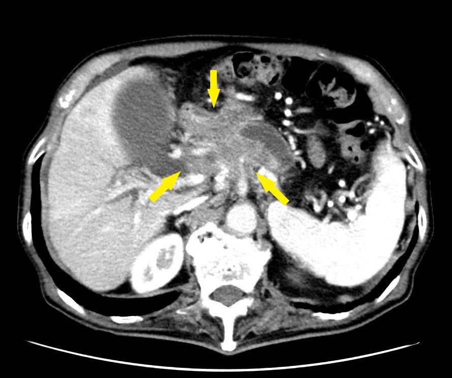 頭頸部のCT・MRI 胸部のCT 腹部のCT 肝胆膵のCT 急性腹症のCTセット